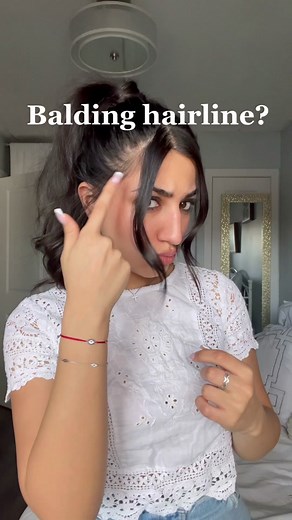 Effective Hairstyles and Tricks for Thinning Hair