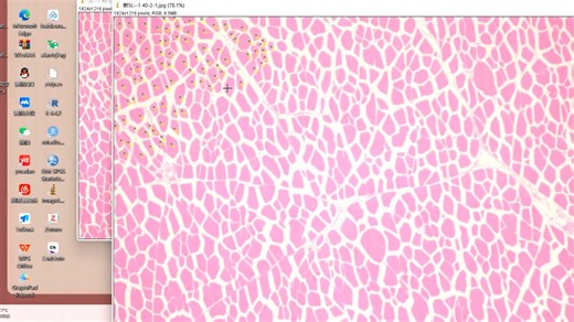 如何用image J 精准计数