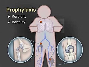 Venous Thromboembolism Prophylaxis after Hip or Knee Arthroplasty