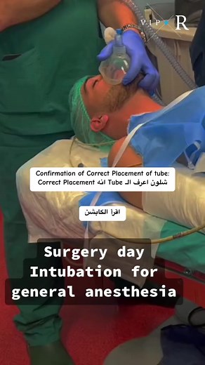 Confirmation of Correct Placement of tube: شلون اعرف الـ Tube انه Correct Placement #تخديريون🖤✨ #تخدير #تخدير_موضعي #anaesthesia #anaesthesialife #anaesthesialife #تخدير_عام #تخديروانعاش #general_anaesthesia #anaesthesia_technician