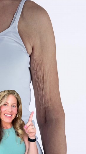 3.8K views · 36 reactions | Take that first step toward the “after” you’ve been wishing for. Grab Crepe Erase’s 2-Step Essentials System using at crepeerase.com/getyours today!  #skincarebeforeandafter#bodycareproducts#bodycareroutine | Crepe Erase | Facebook