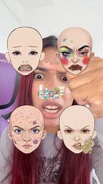 What do I have to do?