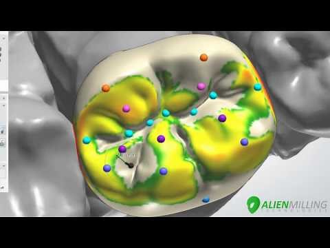 Professional Full Contour Crown Design