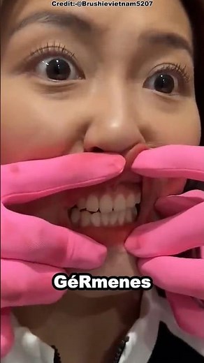 Why you MUST brush your teeth every day! 🪥😬 #shorts #reels #viralshorts #humor