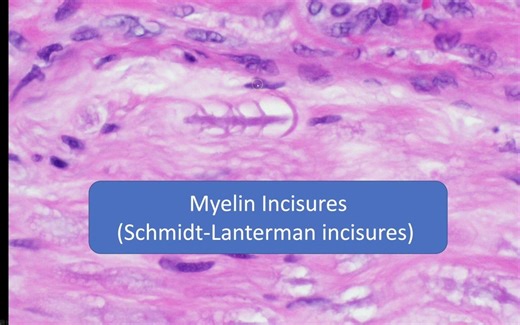 Nerve vs Smooth Muscle vs Dense Regular Connective Tissue