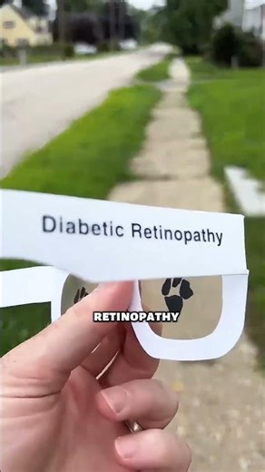 What Do Blind People Really See? 😳 (@Blindonthemove on YT)