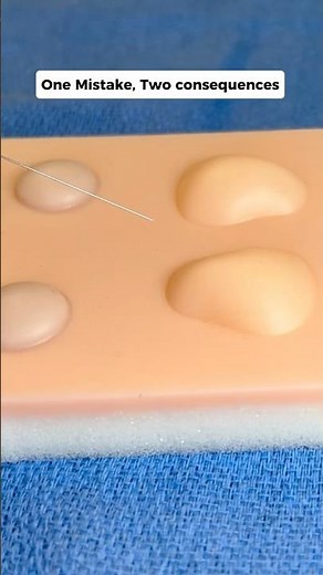Abscess Anesthesia Mistake → Two Consequences 🧐 #clinicalskills #medicaleducation #shorts #howto