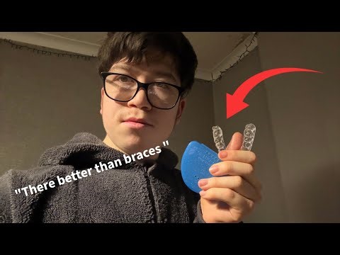 How to take your retainers out (much easier than braces)￼