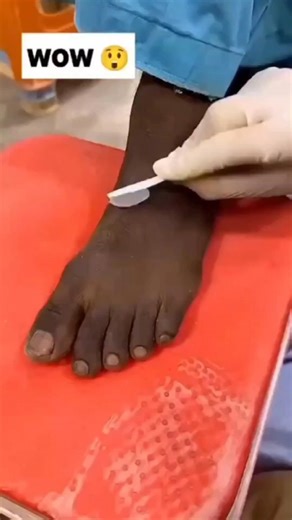 Fair Feet Tips | Remove Feet Darkness & Tanning Instantly #fairfeettips #feetdarkness #ytshorts