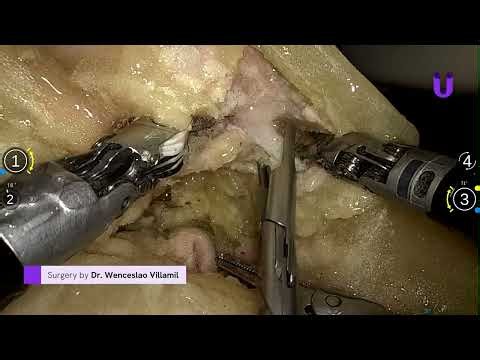 Robotic & Laparoscopic Surgery Workshops - Simulation Solutions