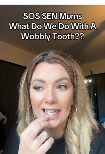 Navigating Wobbly Teeth with Kids: Tips for Parents
