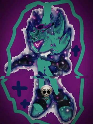 #edit OMNI UNIVERSAL SONIC INFINITY GENERAL