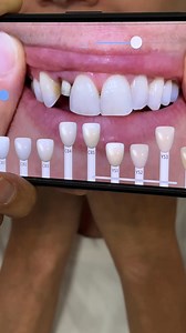 149K views · 448 reactions | digital shade matching from lsk121 app | Luke Kahng | Facebook