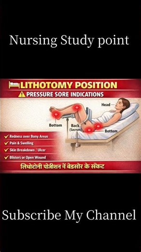 Lithotomy position #viral #hospital #internationallyeducatednurse #nurse