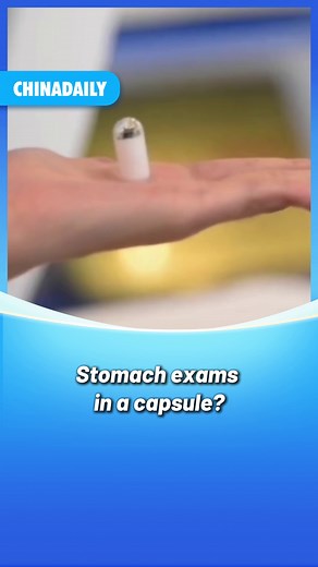 19K views · 410 reactions | Imagine transforming stomach exams with a simple swallow. In China, a tiny #AI-powered capsule is doing just that. In just 8 minutes and without tubes or anesthesia, the exam is complete — painless and hassle-free. At under 280 US dollars, this innovation is becoming more accessible, promising to revolutionize healthcare for countless patients. #health #healthcare #tech | Tech News | Facebook