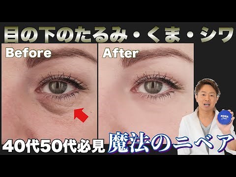 目の下のたるみ！目のシワ！目のクマはニベアでマッサージ！！