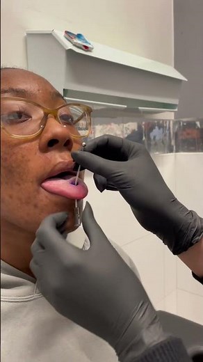 Tongue pierced by @undergroundbodypiercing #tonguepiercing