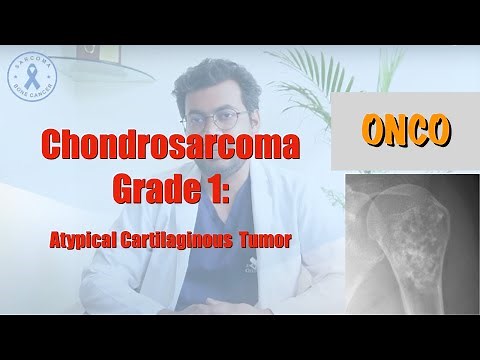 Understanding Chondrosarcoma Grade 1: Atypical Cartilaginous Tumor Explained | Dr. Deepak Garg