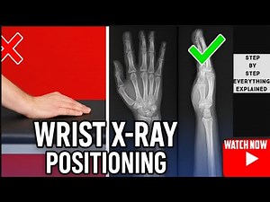 Wrist X-ray Like a Pro: AP & Lateral Positioning Guide for Students