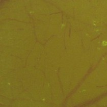 Video: Two-Photon in vivo Imaging of Dendritic Spines in the Mouse Cortex Using a Thinned-skull Preparation