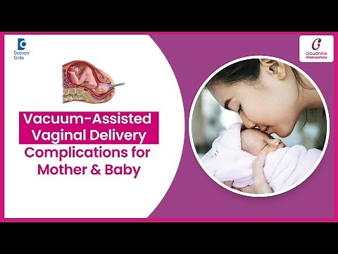 Vacuum Assisted Vaginal Delivery - Dr.Nandyala R Padmapriya at Cloudnine Hospitals | Doctors' Circle