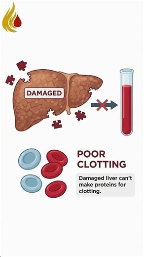 Is a Low Platelet Count Cancer? The Truth You Need to Know