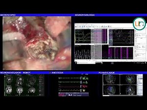 Neurorgs.net- Glioma surgery