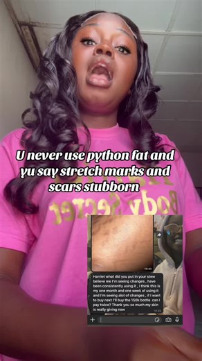 Python fat works magic on stretch marks