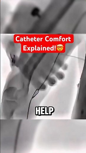This Is How Catheter Discomfort Is Reduced