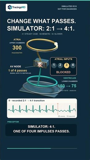 Atrial Flutter: Rate Is Not Rhythm
