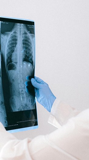 11K views · 486 reactions | Diese Dinge solltest du vor deinem MRT-Termin wissen! ☺️ Du willst mehr über die Radiologie und das MRT erfahren? Dann folge uns! 珞 Disclaimer: Die Informationen in diesem Video sind primär zur Unterhaltung. Die Inhalte sind rein informativ und stellen keinen Behandlungsvertrag dar und ersetzen keine ärztliche Diagnostik und Therapie. #radiologie #mrt #mr #radiologe #arzt #praxis #ordination #baden #medicent | Ordination Dr. Wolfgang Kopsa | Facebook