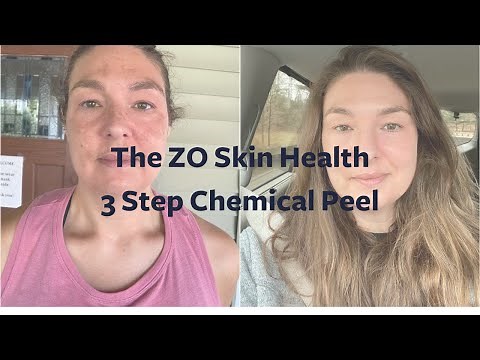 ZO® 3 Step Chemical Peel Results