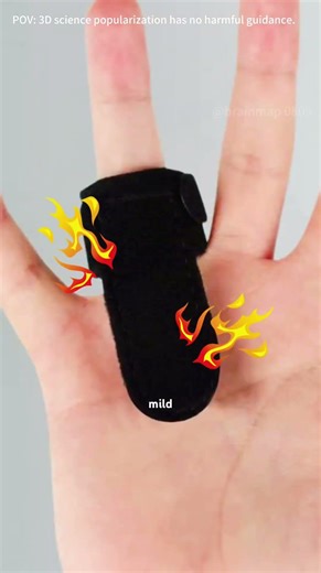 Trigger Finger Surgery 3D Animation #triggerfinger #triggerfinger? #triggerfingerrelease