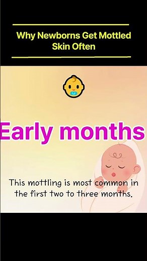 Why Do Newborns Show Mottled Skin So Often? | Baby Skin & Temperature Changes