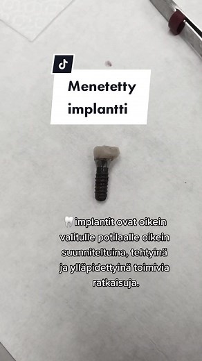 🦷implantti tarjottimella#hammaslääkärissä #hammaslääkäri #hammasimplantti #potilasvalinta #hoidonsuunnittelu #qadental #tiktoksuomi #suomitiktok #fyp #foryou