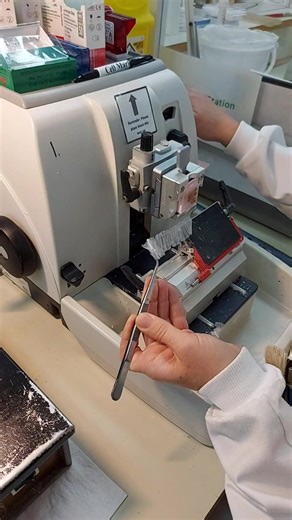 One of the steps of diagnosing a colonic polyp 🔬🥼 #science #biomedicalscience #learnontiktok #pathology #fyp #medicine