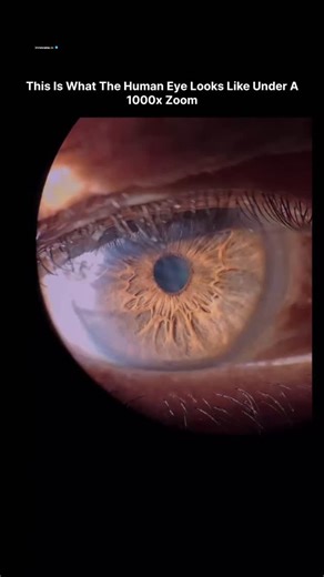 𝗂𝗇𝗇𝗈𝗏𝖺𝗍𝖾.𝗂𝗈 on Instagram: "This Instagram Reel presents a microscopic examination of the human iris magnified to 1000 times its normal size. The footage captures the intricate, radial arrangement of collagen fibers and stromal layers that form the iris's textured surface, surrounding the dark central pupil. These structures, which appear smooth and uniform to the naked eye, reveal a complex network of ridges and folds under magnification, resembling elongated, branching patterns that f