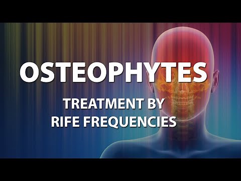 Osteophytes (Bone Spurs) - RIFE Frequencies Treatment - Energy & Quantum Medicine with Bioresonance