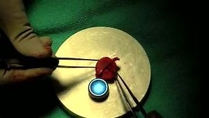 EVOLVE™ Radial Head Surgical Technique Video - Part 4 of 10