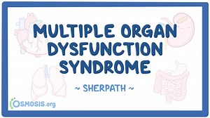 Multiple Organ Dysfunction Syndrome (MODS): Video, Causes, & Meaning | Osmosis
