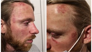 VIDEO. Toulouse : les vigiles du restaurant La Voile Blanche ont-ils tabassé un client ?