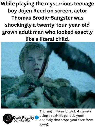 The Real-Life "Benjamin Button" of Game of Thrones… 👶🤯