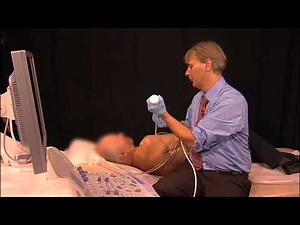 Segments of the aorta TTE