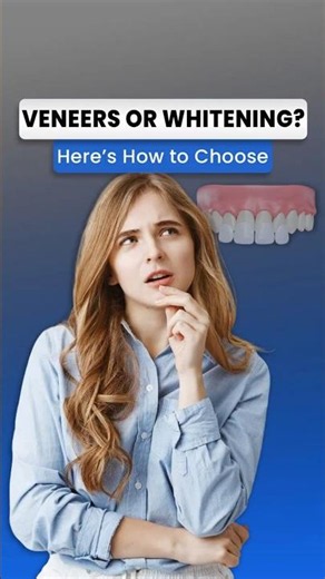 Veneers vs Teeth Whitening: Which One Is Right for You?