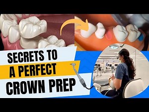 Ace Your Bench Test on FIRST Try | Crown Prep Tricks + Free Resource