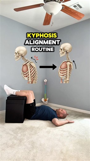 4 Exercises to Help Improve Kyphosis and a Rounded Upper Back