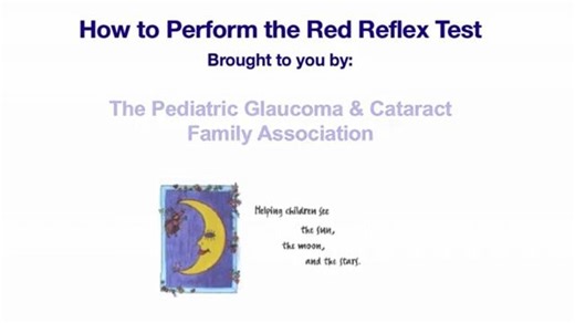 Red Reflex Detection video - 红光反射|眼科检查