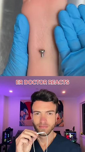 961K views · 3K reactions | How to remove a nail from a foot | LifeOfADoctor | Facebook