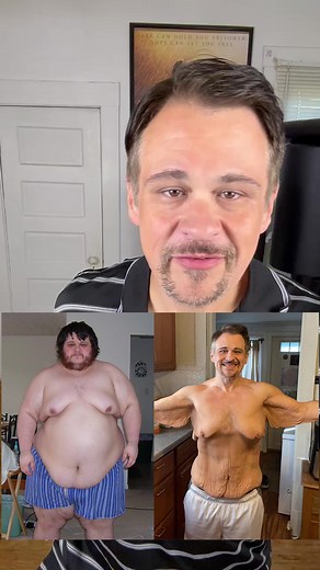 20K views · 1.4K reactions | Will you see definition after loose skin removal surgery? I show you the difference between the day after surgery and 175 days after. It usually takes months for the swelling to subside enough to see muscle definition after surgery but be patient and it will come! #weightlosstransformation #weightloss #skinremovalsurgery #looseskin #looseskinremoval #definition #weightlossresults #educational #losetogain #dustinsilasbrown | Dustin Silas Brown | Facebook