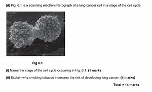 (d) Fig. 6.1 is a scanning electron micrograph of a lung cancer... | Filo